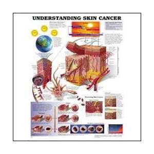 Understanding Skin Cancer Anatomical Chart 20 X 26 
