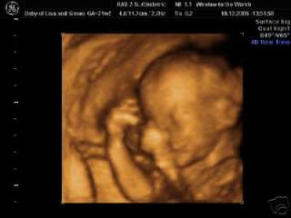 4D baby scan pictures 26 28 weeks items in WINDOW TO THE WOMB 4D BABY 