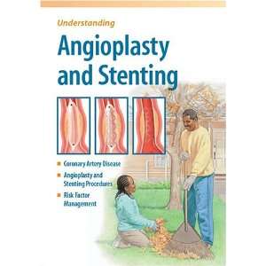 Angioplasty & Stenting, Understanding [ PDF] [Digital]