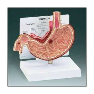   Chart Company   Stomach with Ulcers Model Industrial & Scientific