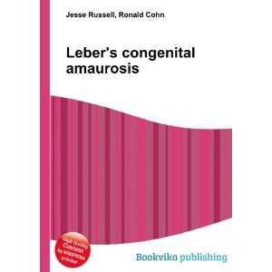    Lebers congenital amaurosis Ronald Cohn Jesse Russell Books