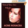 Rosacea   Natural Skin Care Help for Acne Rosacea by Julia Busch 